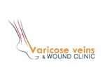 varicose veins laser 150x110 1